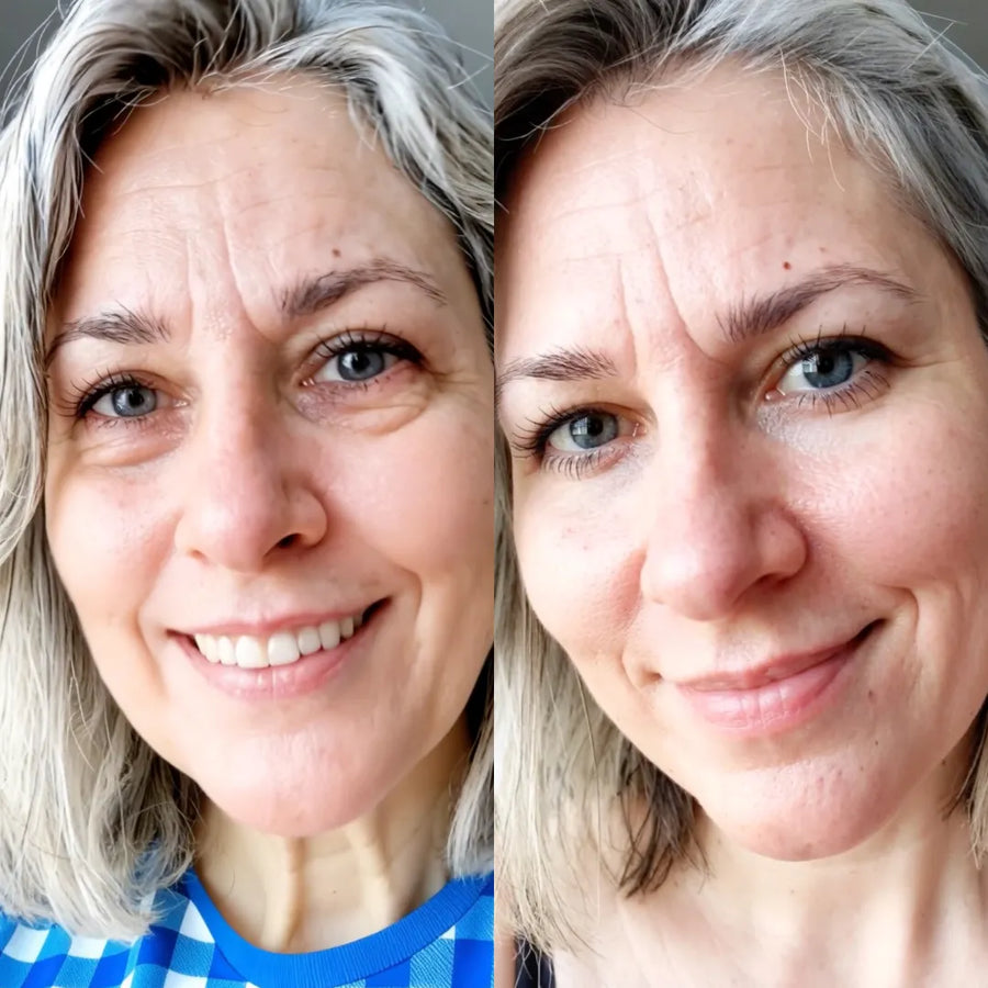 Before and after, 10 weeks