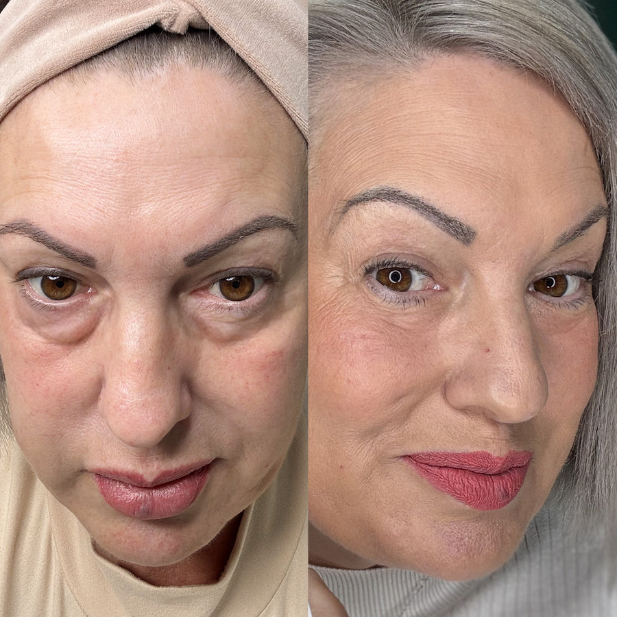 Lily R. before and after