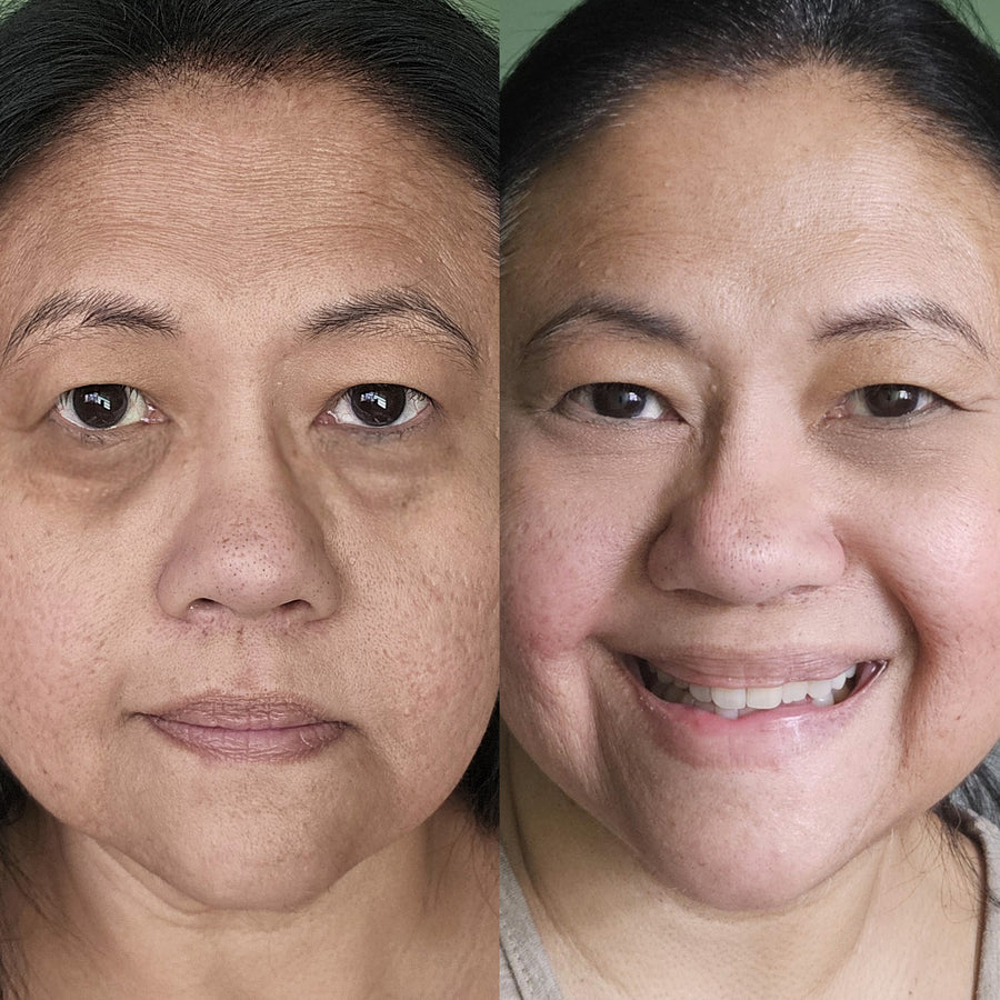 Gabrielle P. before and after