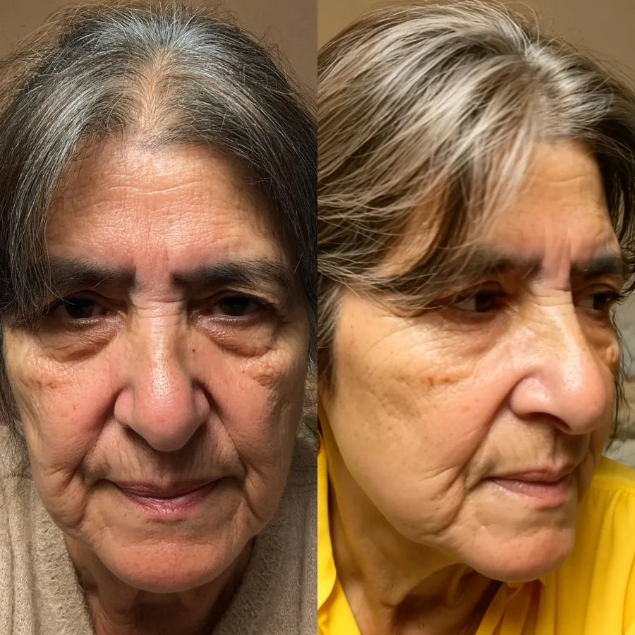 Mildred R. before and after