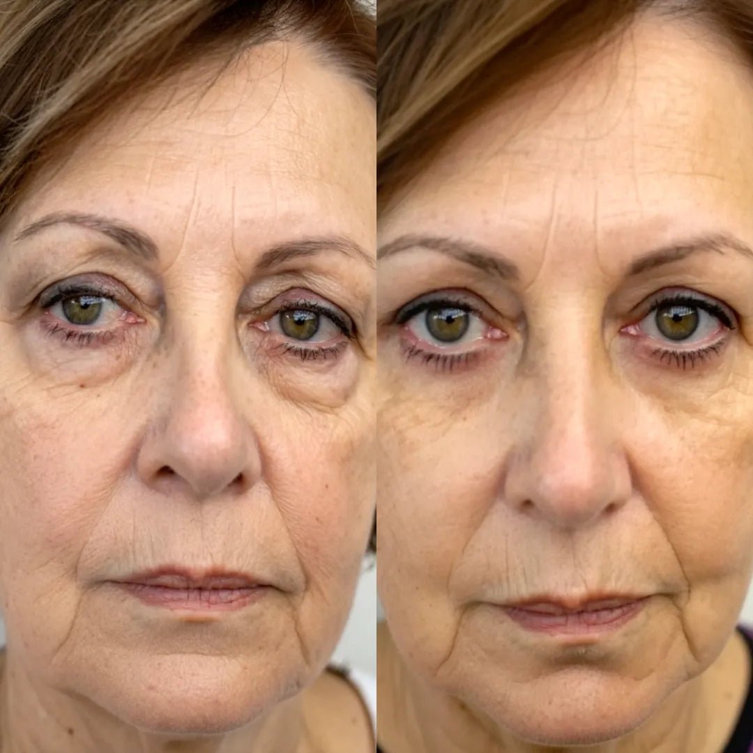 Before and after