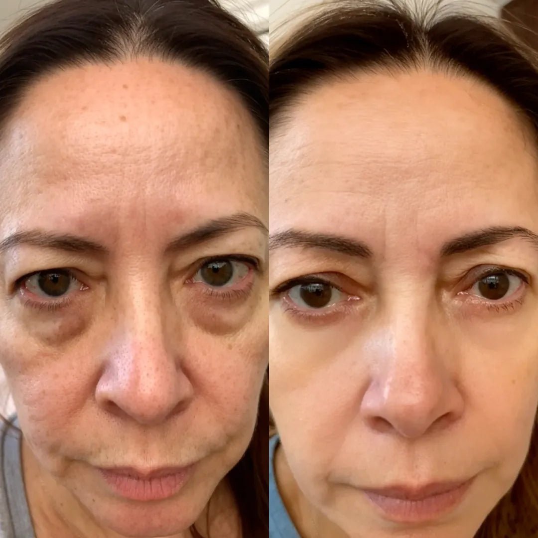 Before and after, 6 weeks