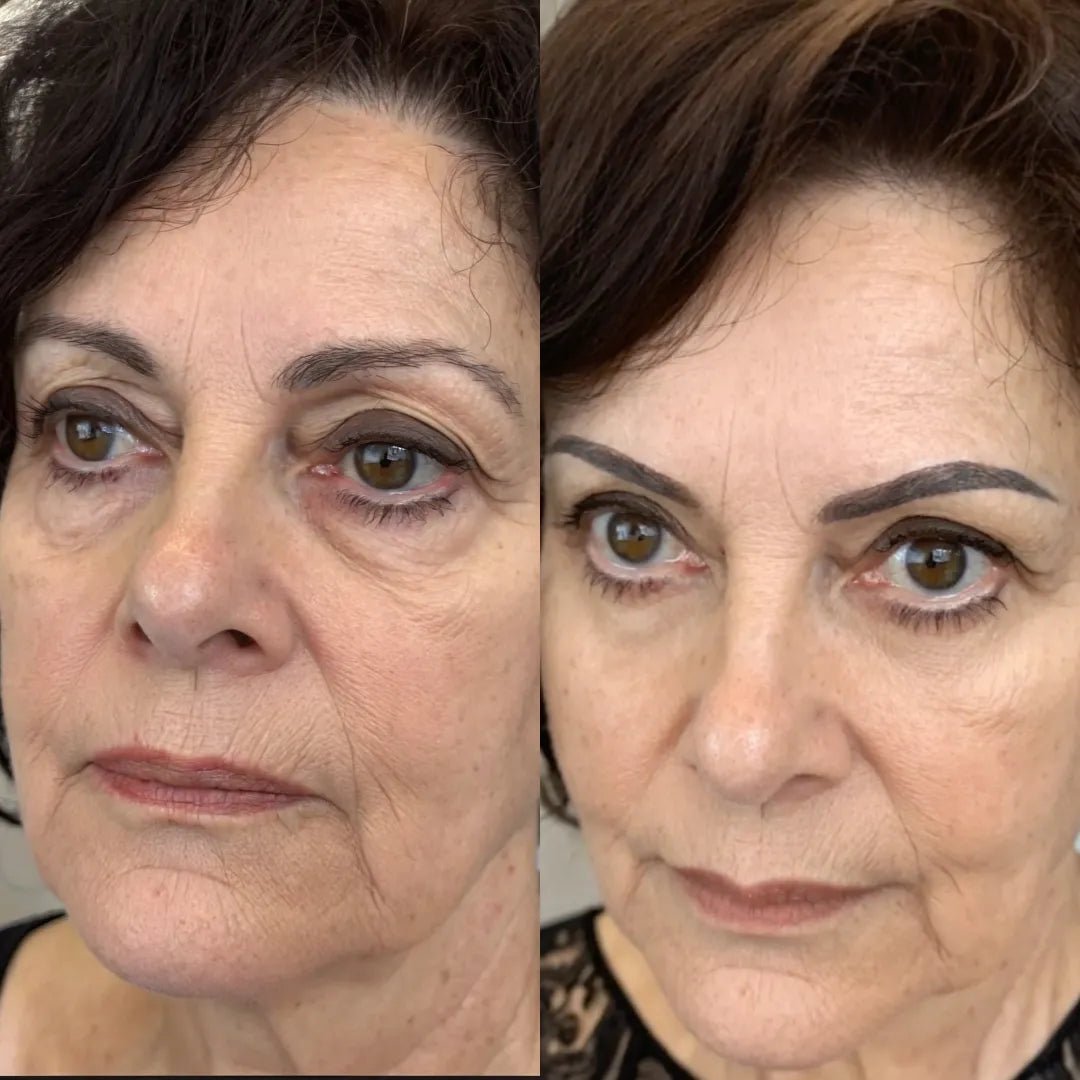 Before and after, 8 weeks