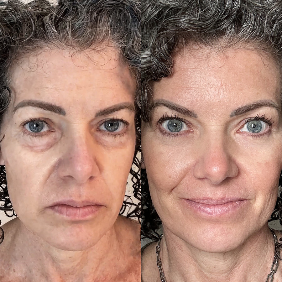 Yasmine T. before and after