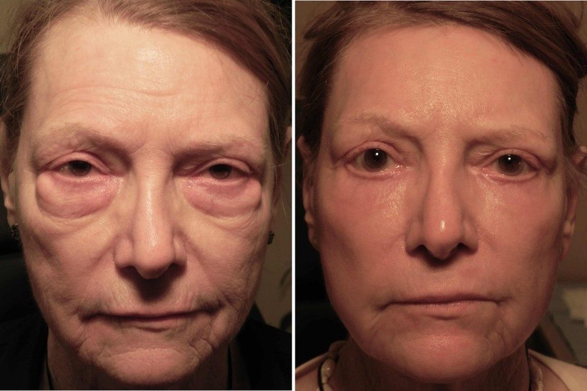 Customer before and after using LIFT.