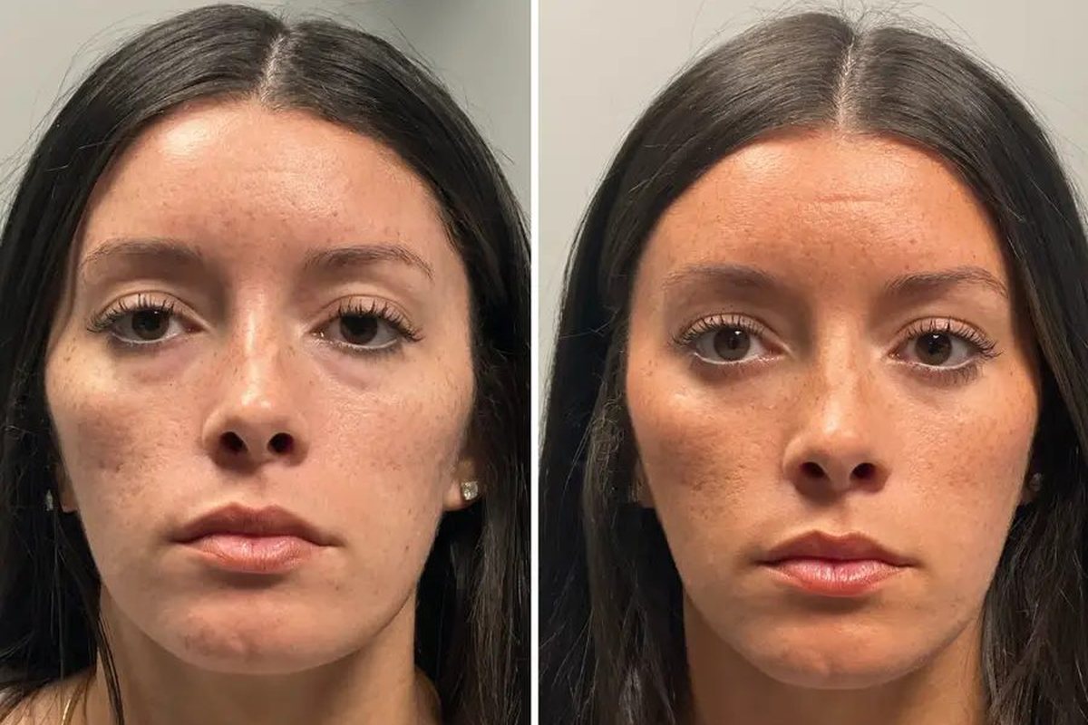 Customer before and after using LIFT.